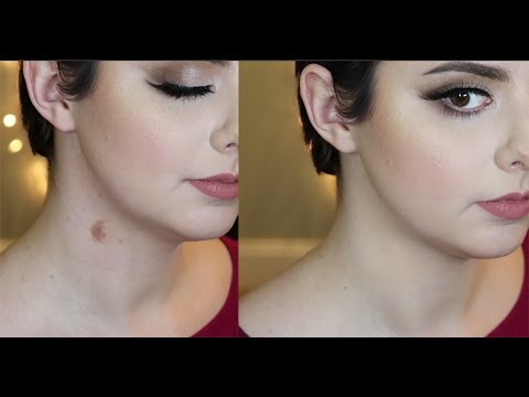 How To Hide Or Cover A Hickey With Or Without Makeup 1
